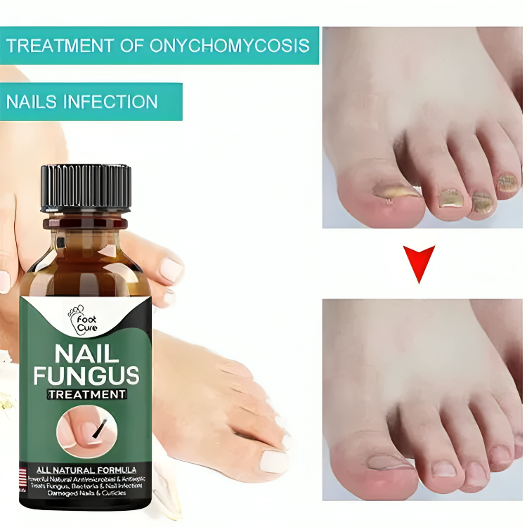 Nail Fungas Repair Serum