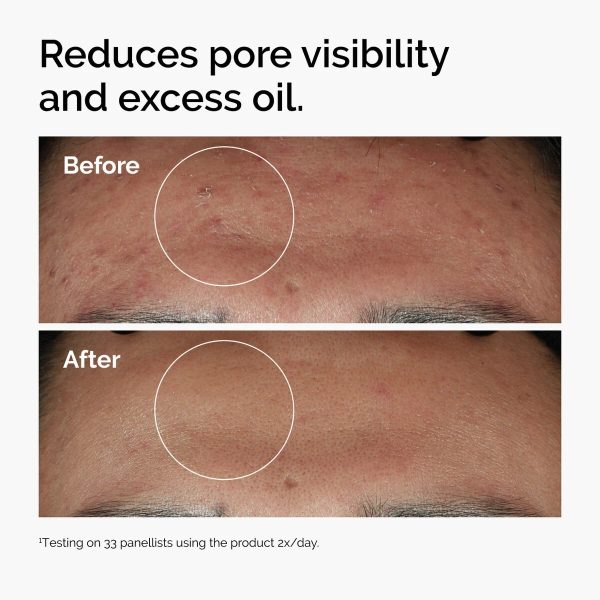 The Ordinary Niacinamide 10%+ Zinc 1% Face Serum (ORIGINAL)