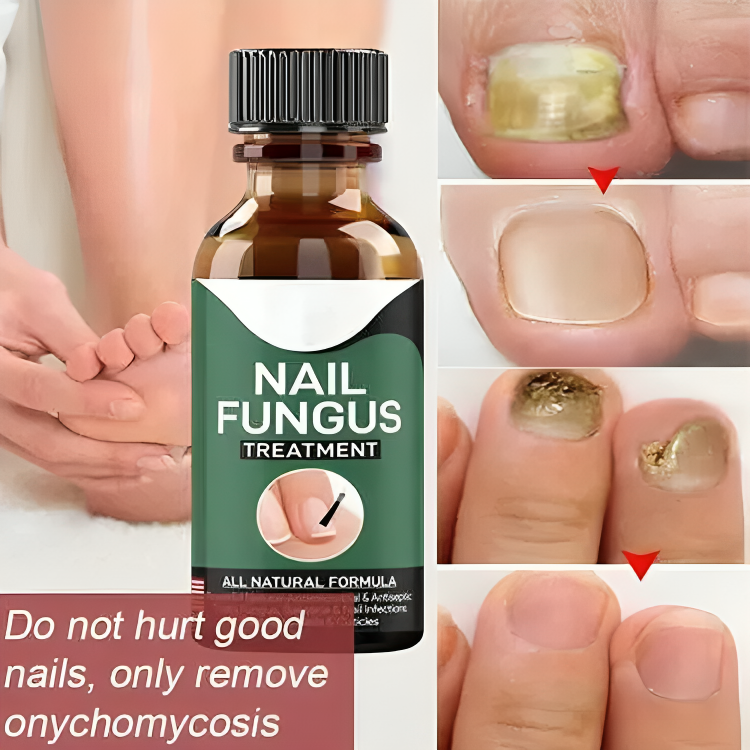 Nail Fungas Repair Serum